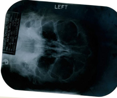 Рентген-снимки открывают тайны Мэрилин Монро